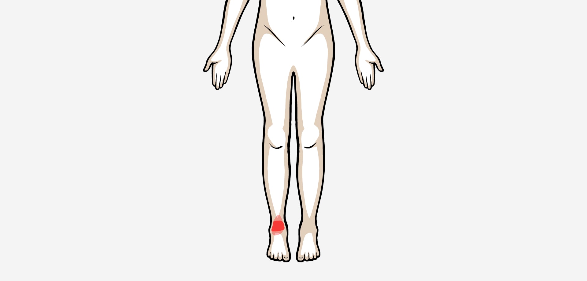 Dolor anterior